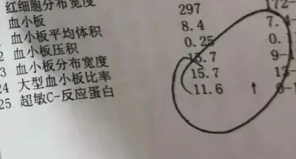 如何知道体内炎症水平高不高