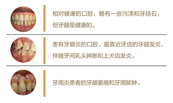 美乐家生命活力营养宝典-口腔健康 保护牙齿